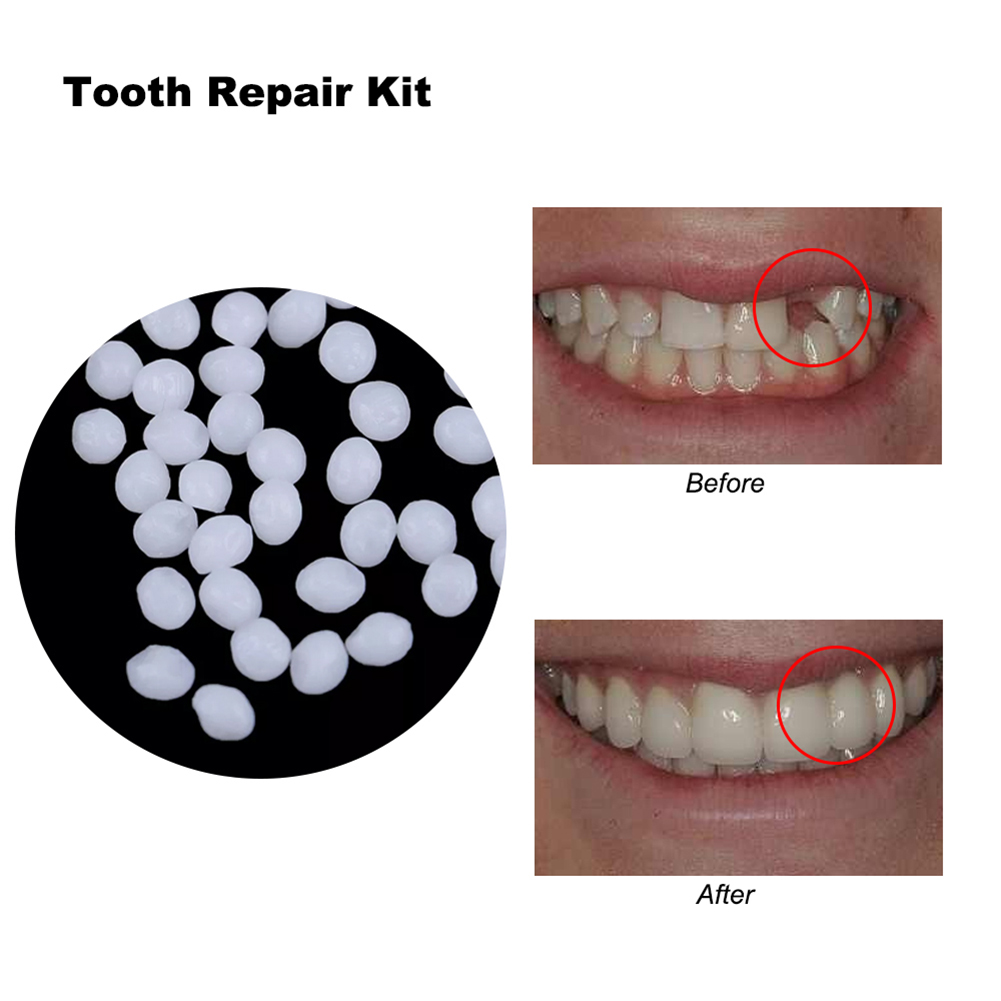 Teeth Whitening Diy - 10/100g DIY Dentures Teether Handmade Solid