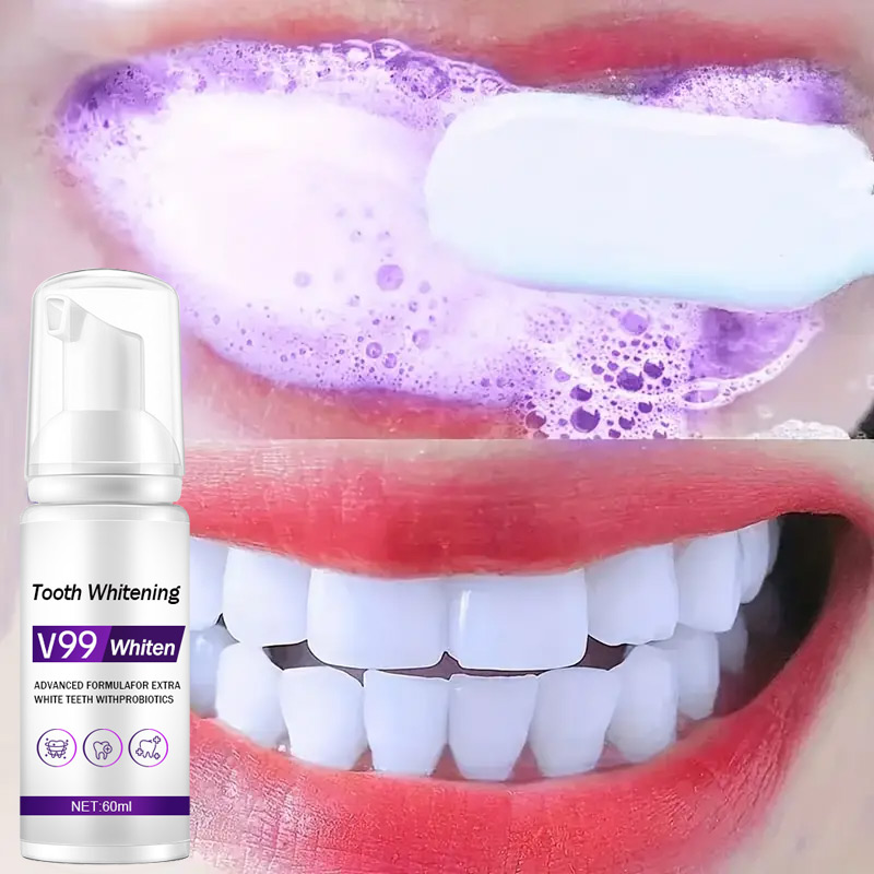 Mousse V99 Toothpaste Teeth Cl - đánh giá và giá Teeth Whitening Mousse