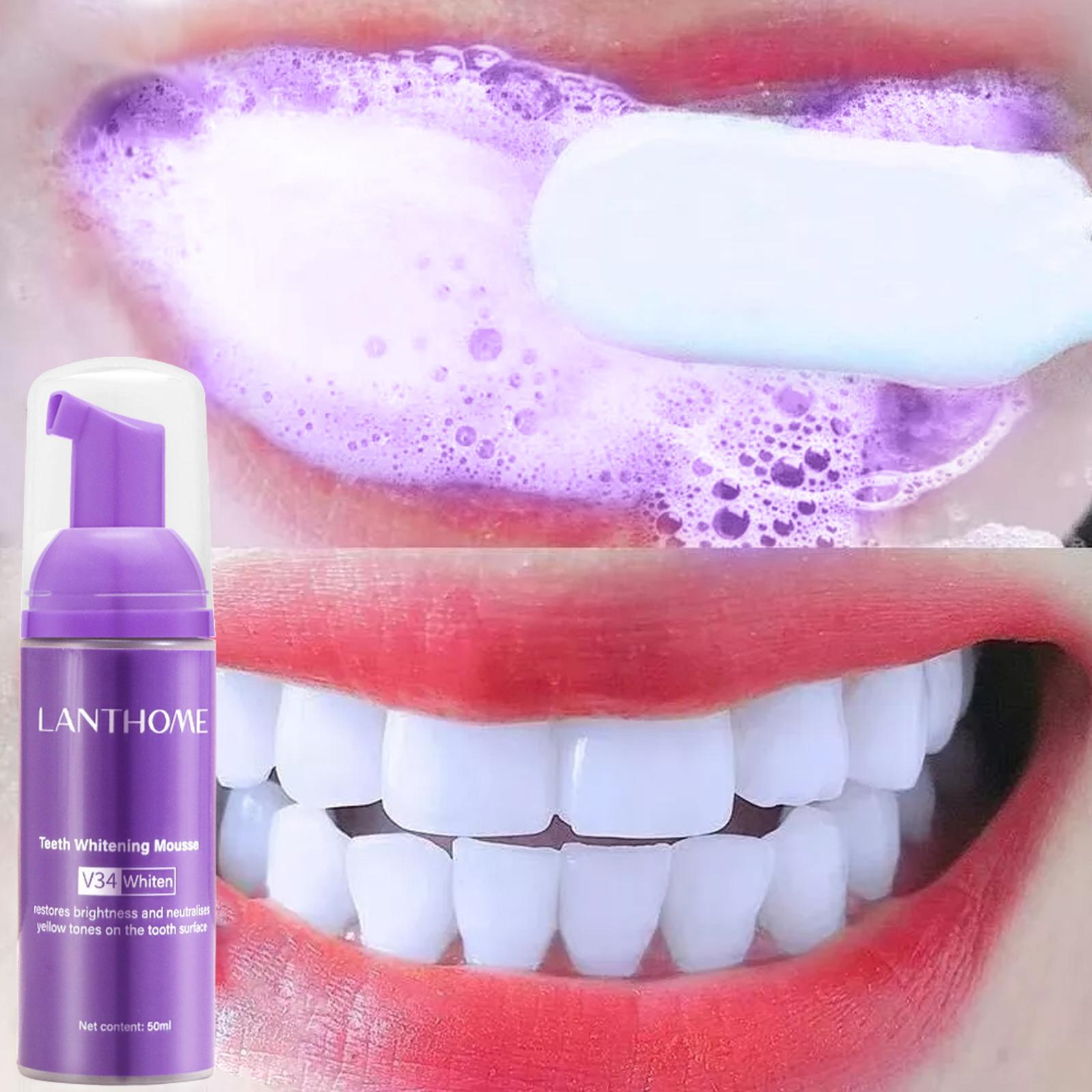 V34 Mousse Teeth Cleaning Toot - đánh giá và giá Teeth Whitening Mousse