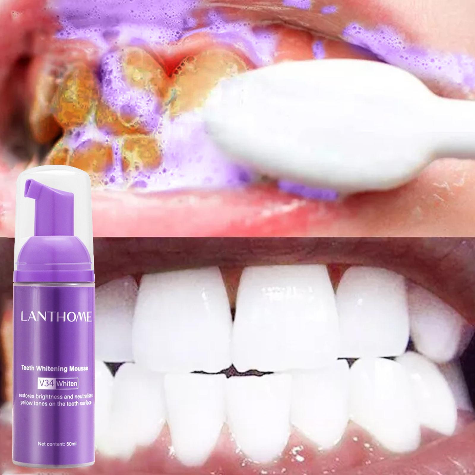 V34 Mousse Teeth Cleaning Toot - đánh giá và giá Teeth Whitening Mousse