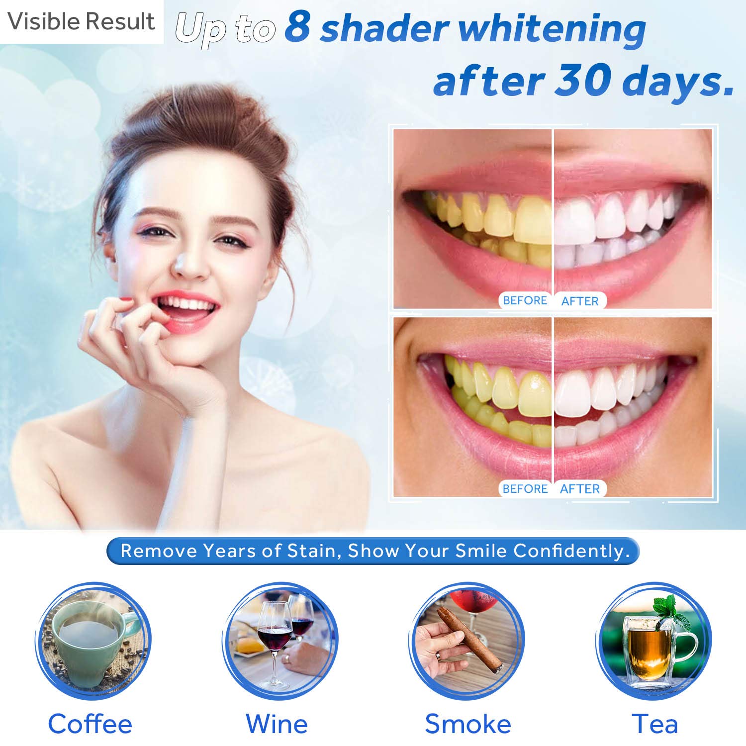 Teeth Whitening Gel Refill Syr - đánh giá và giá Teeth Whitening Groupon
