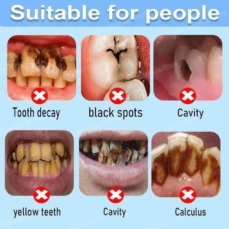 Anti Decay Toothpaste Repairs  - đánh giá và giá Teeth Whitening That Works