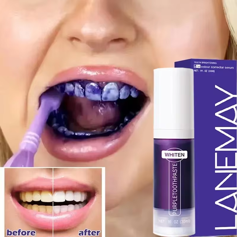V34 Purple Teeth Whitening Too - đánh giá và giá Teeth Whitening Mousse