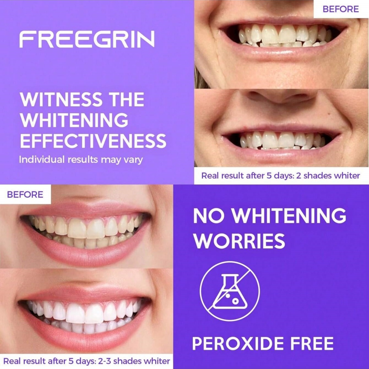 Deluxe Whitening Teeth Sticker - đánh giá và giá Teeth Whitening Groupon