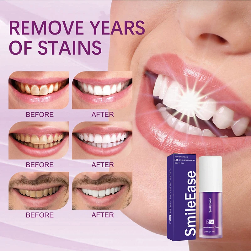 45ml Smilekit Purple Tooth Mou - đánh giá và giá Teeth Whitening Mousse