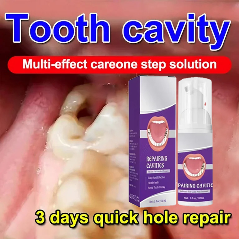 Teeth Cleaning Toothpaste Remo - đánh giá và giá Teeth Whitening That Works