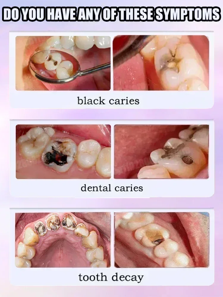 Teeth Cleaning Toothpaste Remo - đánh giá và giá Teeth Whitening That Works